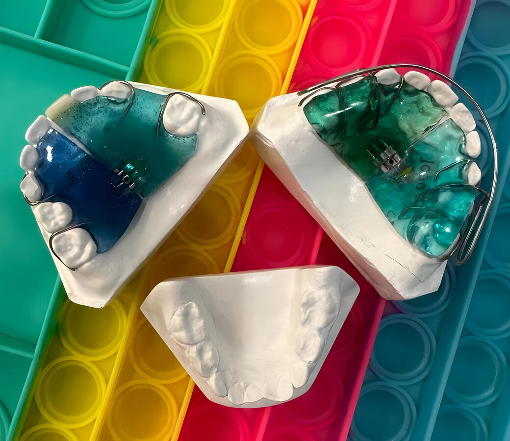 Ortodontia Preventiva